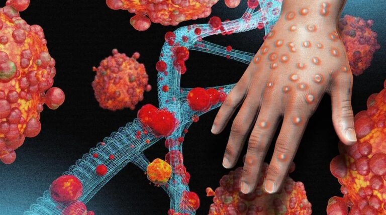 Mpox Virus: Signs, Prevention, and Diagnosis